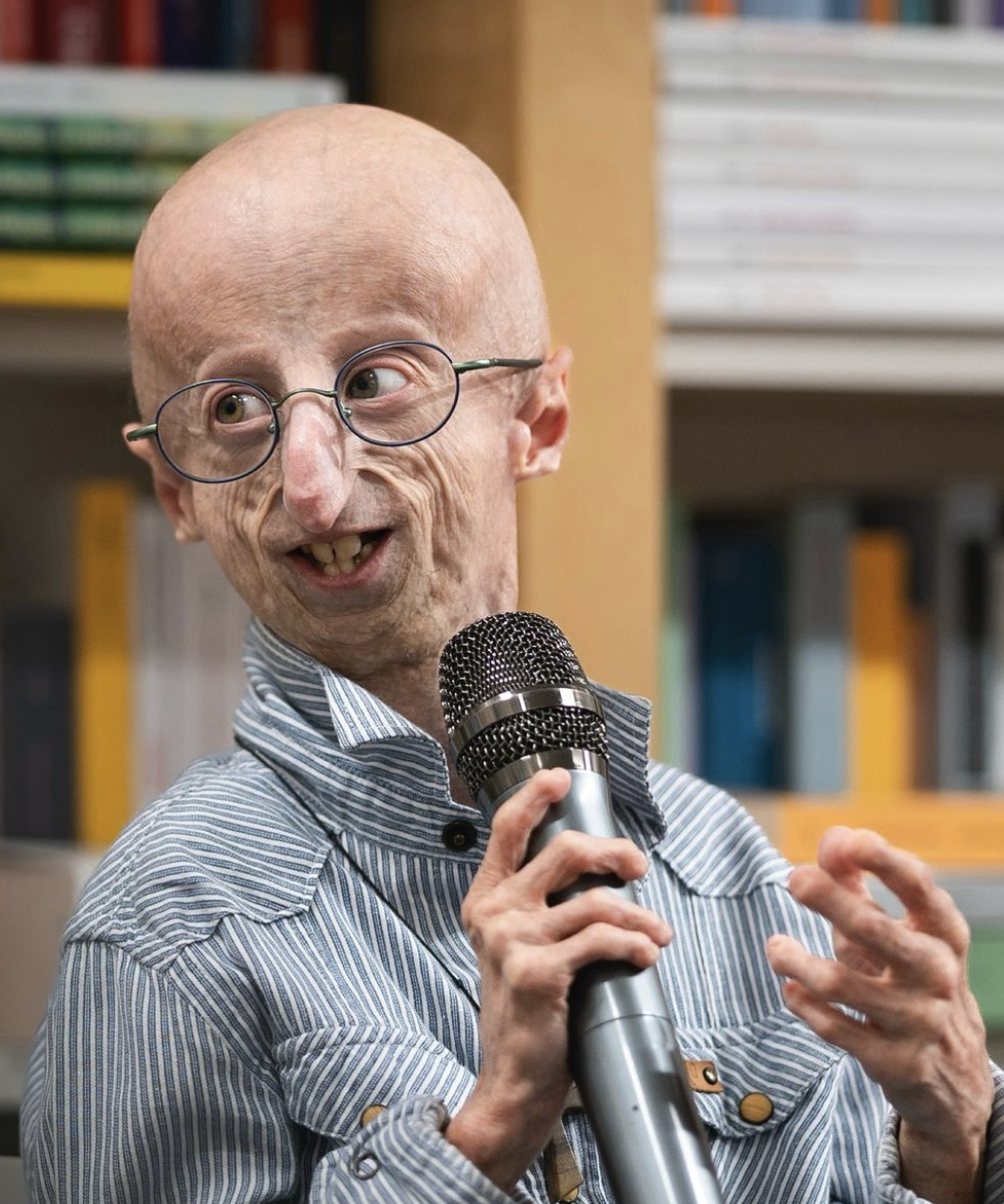 sammy, sammy basso, sammy basso progeria, progeria, sammy basso enfermedad, 