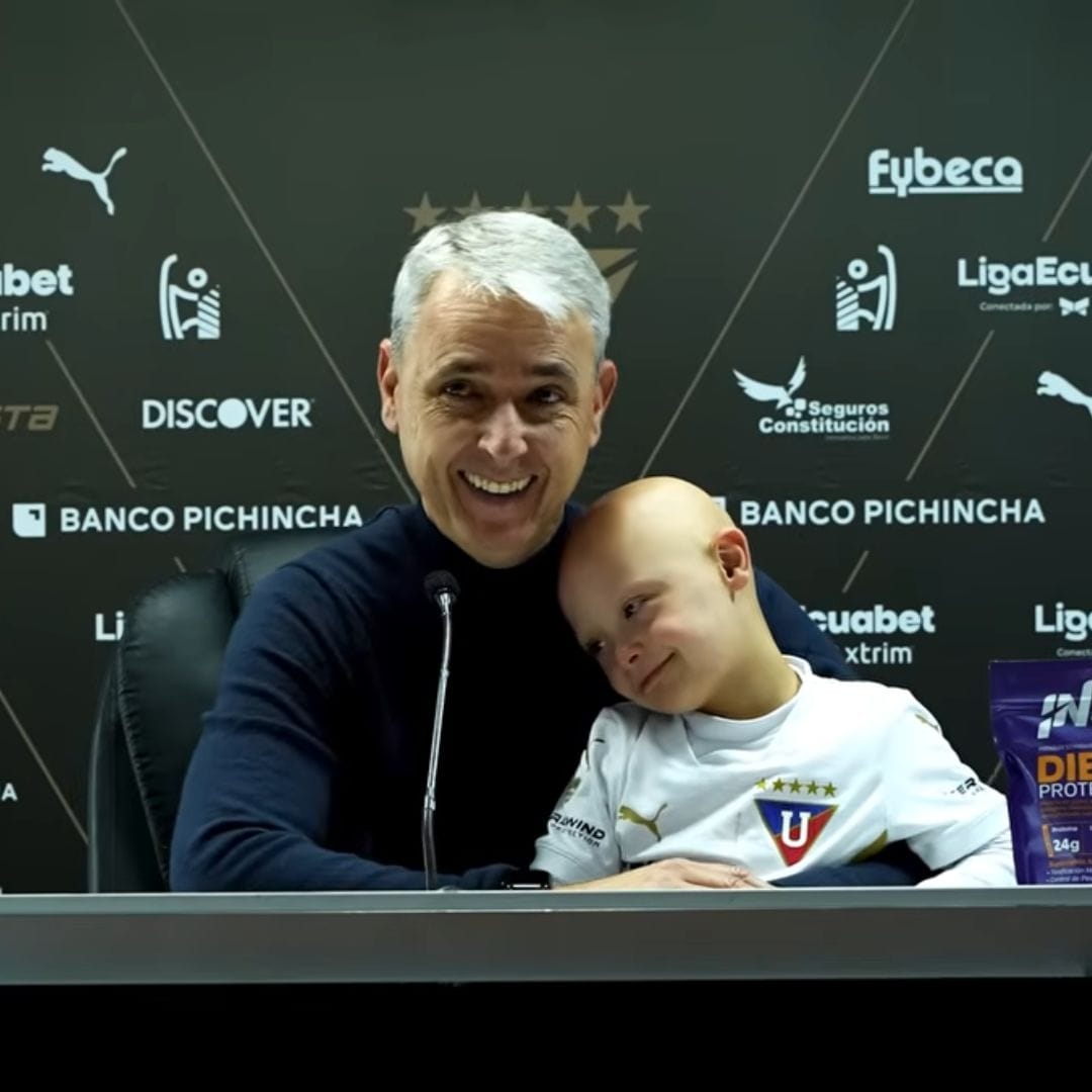 down, sindrome down, sindrome de down, síndrome down, síndrome de down, tiago nunes