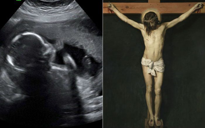 Esta ecografía mostró algo realmente sorprendente: Cristo defiende al no nacido