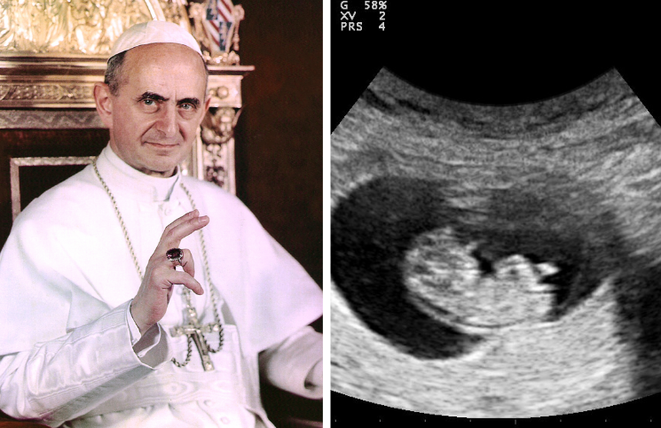 Los milagros provida que convirtieron en santo al Papa Pablo VI