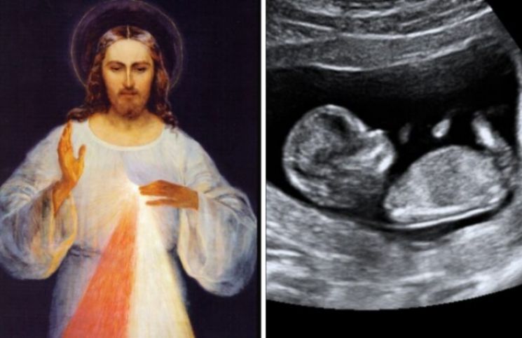 ¿La Coronilla de la Divina Misericordia puede detener el ab*rto? Pistas sobrenaturales en el diario de Santa Faustina